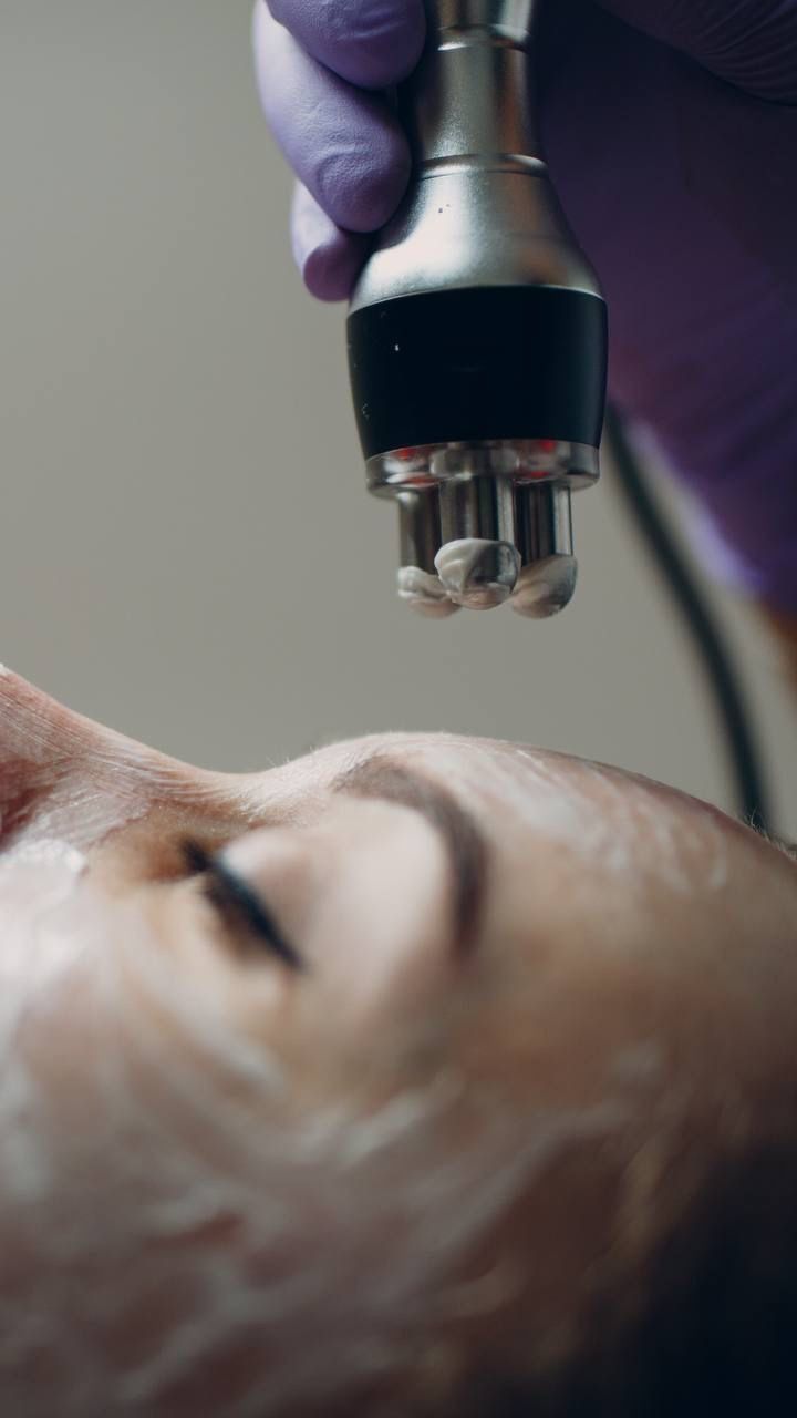 The Hidden Dangers of Radio Frequency Facials: Why You Should Think Twice Before Trying